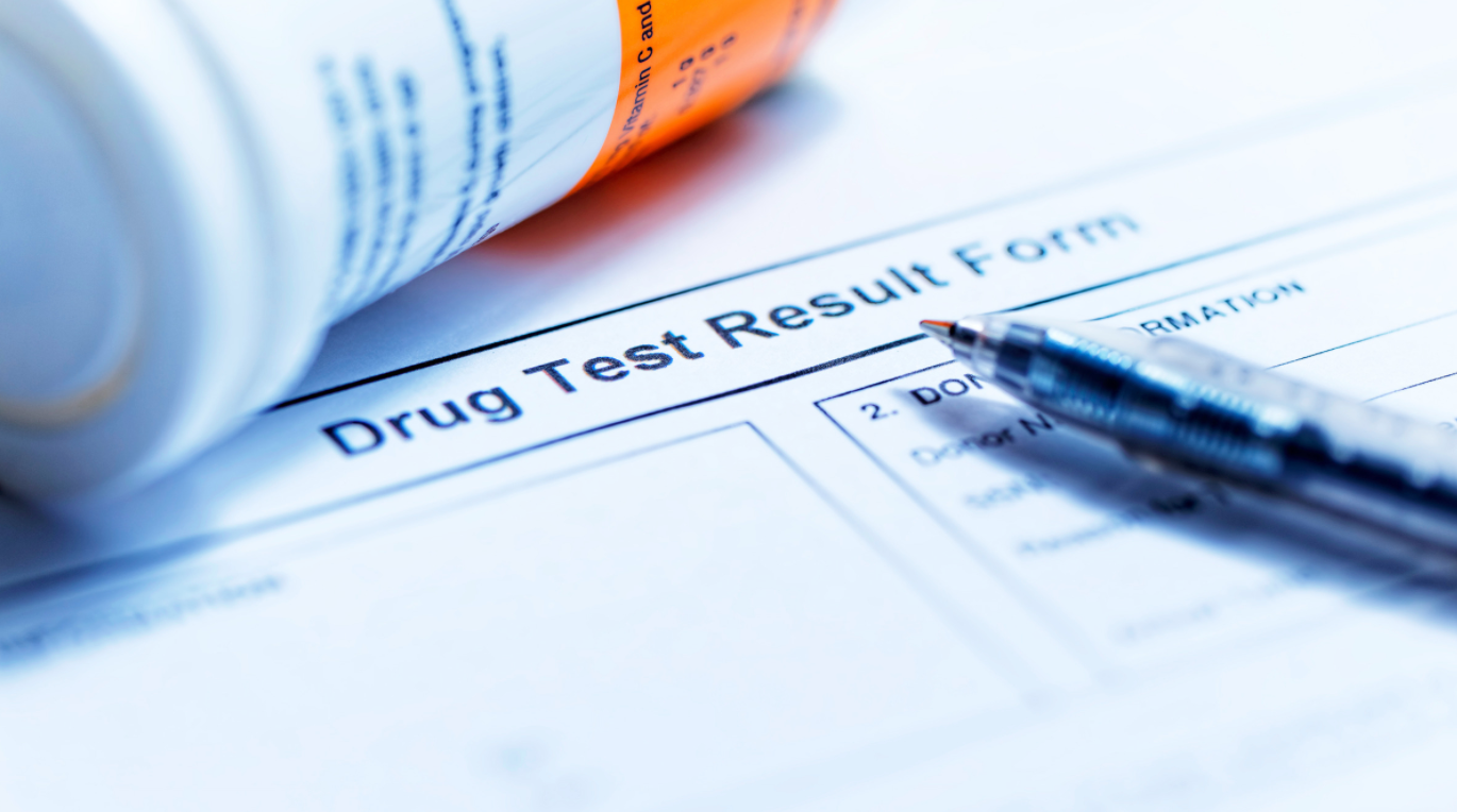 Does CBD Show Up On Drug Tests? Here’s What You Need to Know